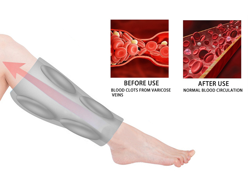 DVT therapy device