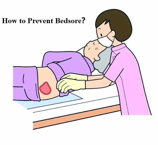 How to Prevent Bedsore Effectively for Intensive Care Patients?