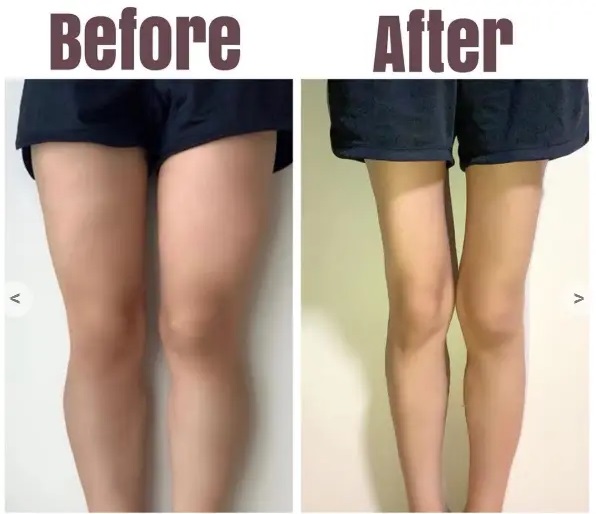 From Stout to Slender, How Did Ms. Li Succeed in Slimming Her Legs?